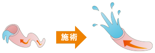 曲がっているホースと真っ直ぐのホースの水の流れの違いの対比