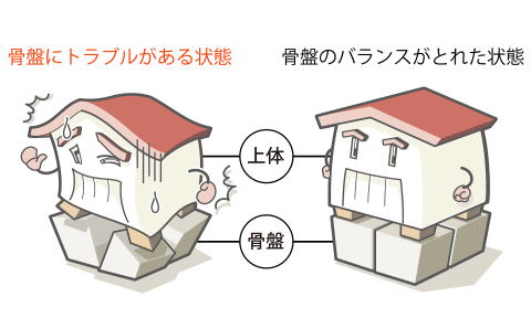 骨盤にトラブルがある場合とない場合の対比